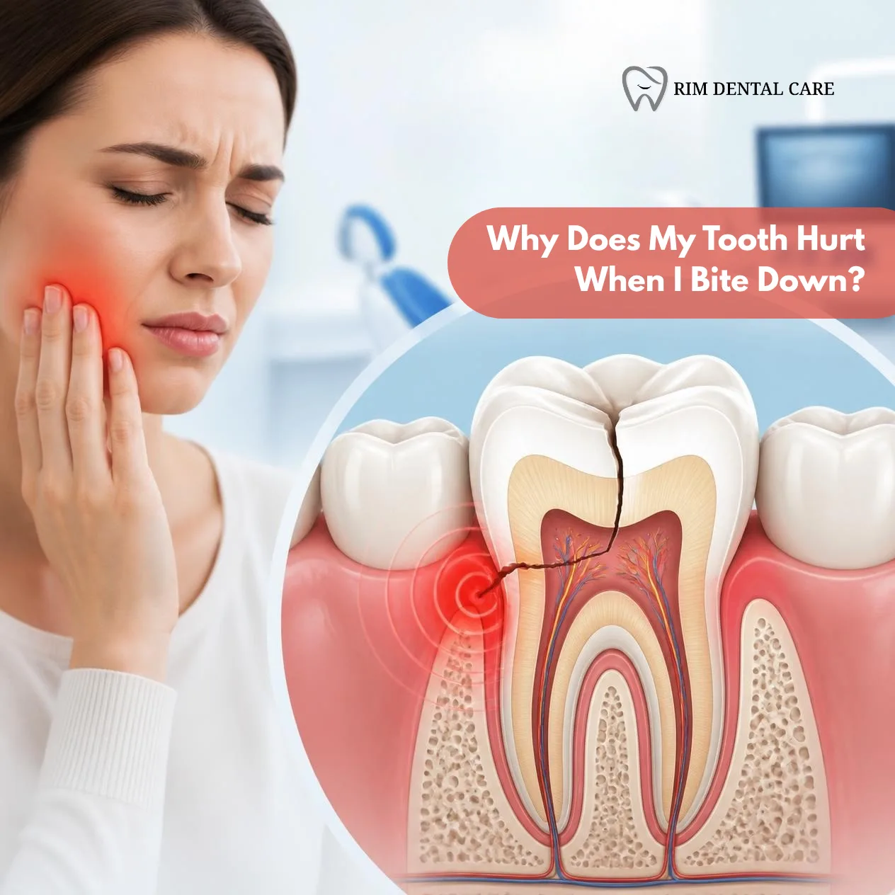 Why Does My Tooth Hurt When I Bite Down?