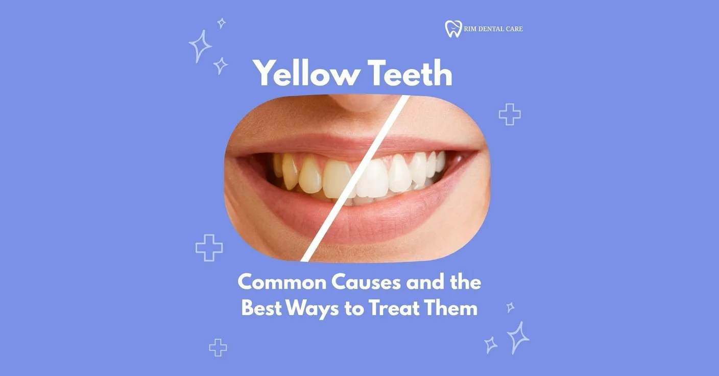 Yellow Teeth: Common Causes and the Best Ways to Treat Them