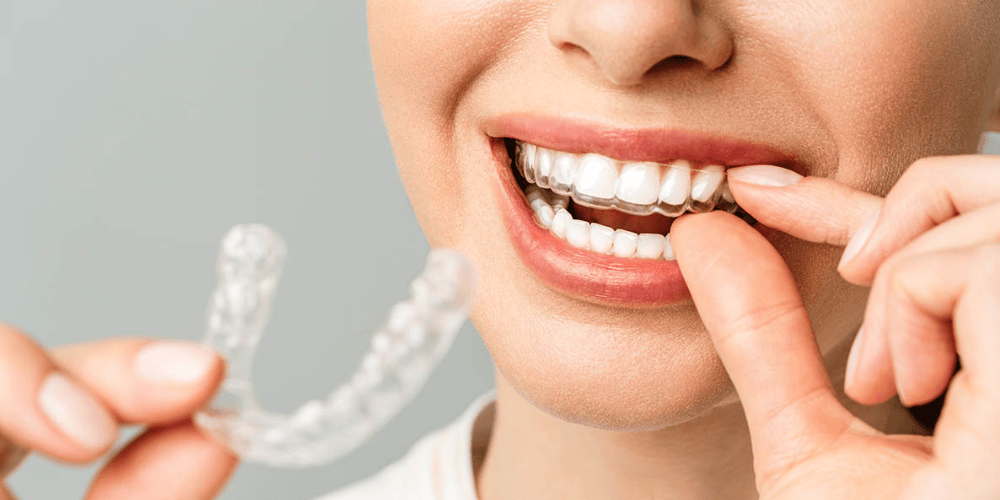 Orthodontic Care Tips